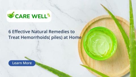 natural remedies for hemorrhoids